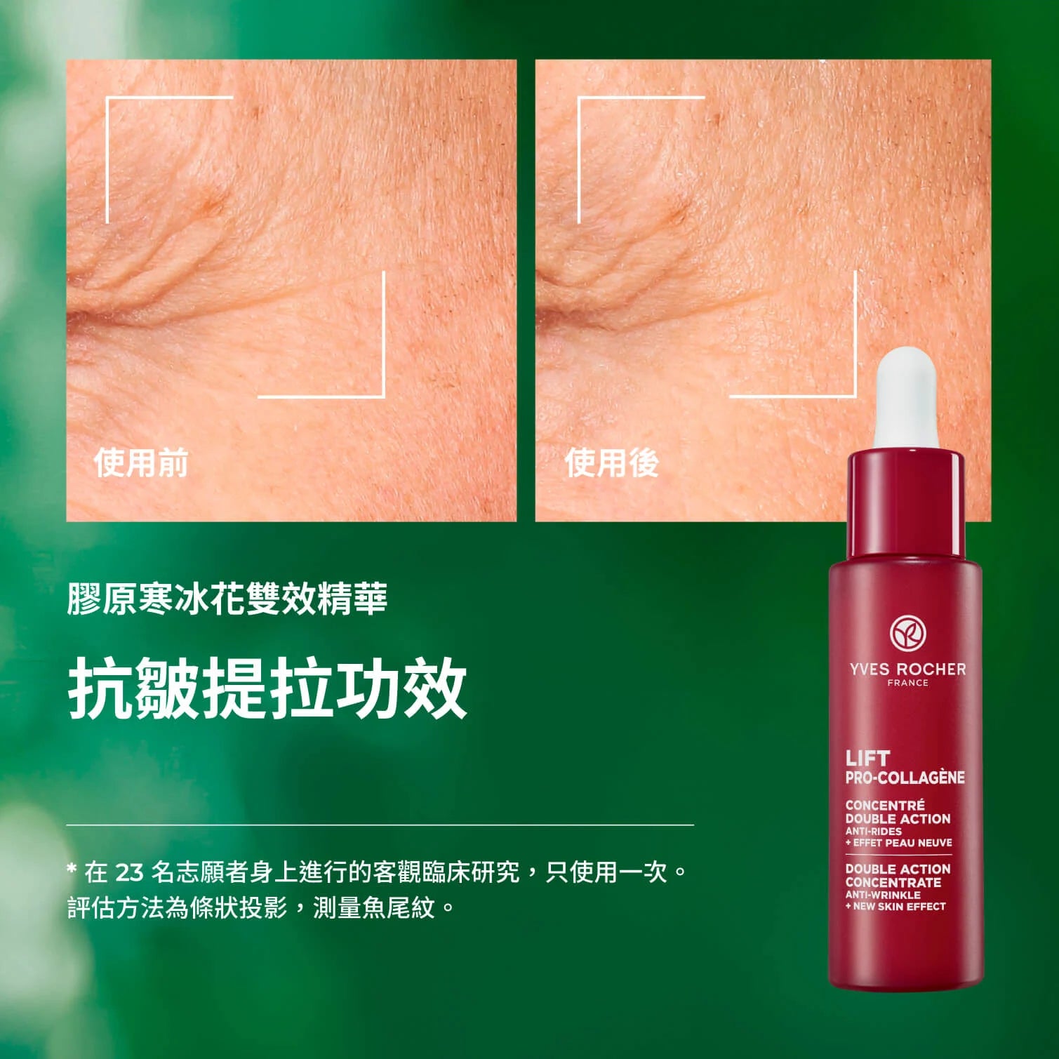 【皇牌】膠原寒冰花套裝